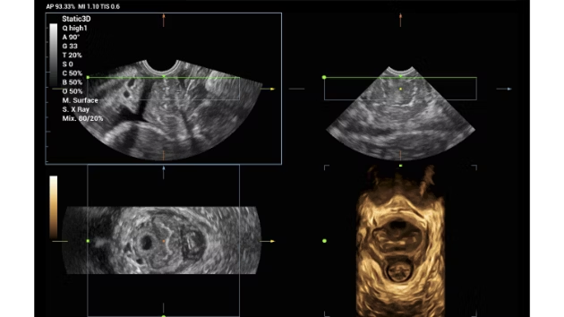 Smart Pelvic