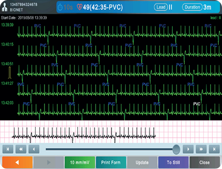 CardioQ5-gallery