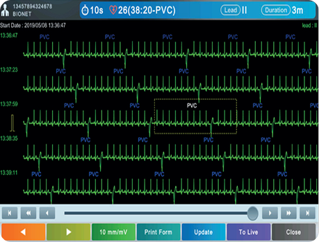CardioQ5-gallery
